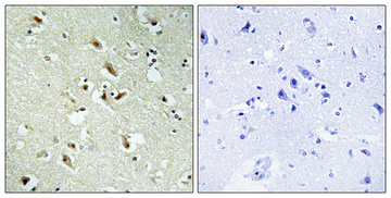 1 - POM121 Polyclonal Antibody AP72002