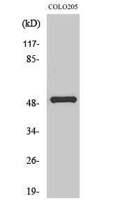 1 - PPP4R1L Polyclonal Antibody AP72025