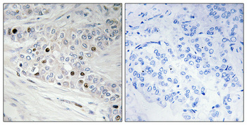 14 - PREP-2 Polyclonal Antibody AP72038