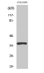 1 - RASSF4 Polyclonal Antibody AP72195