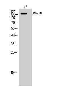 1 - RBM16 Polyclonal Antibody AP72209
