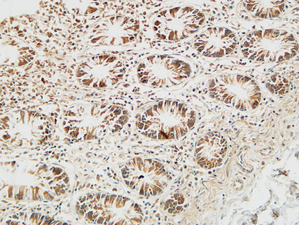 14 - Reg IV Polyclonal Antibody AP72223