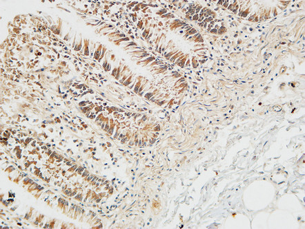 14 - Reg IV Polyclonal Antibody AP72223