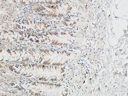 14 - Reg IV Polyclonal Antibody AP72223