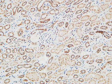 14 - RGS16 Polyclonal Antibody AP72257