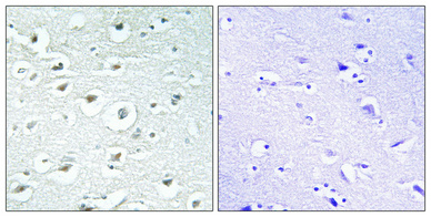 14 - RoXaN Polyclonal Antibody AP72351