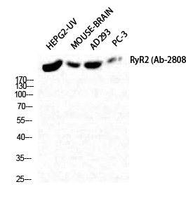 1 - RyR-2 Polyclonal Antibody AP72379