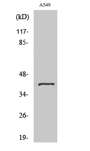 1 - Sarcoglycan-β Polyclonal Antibody AP72399