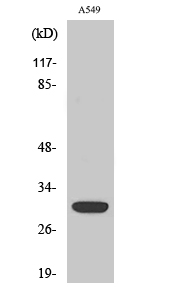 1 - Siah-1/2 Polyclonal Antibody AP72479