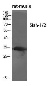 1 - Siah-1/2 Polyclonal Antibody AP72479