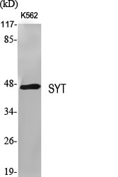 1 - SYT Polyclonal Antibody AP72684