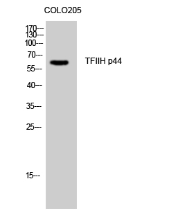 1 - TFIIH p44 Polyclonal Antibody AP72800
