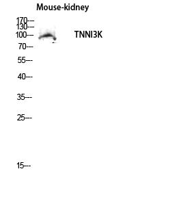 1 - TNNI3K Polyclonal Antibody AP72875