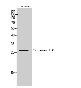 1 - Troponin I-C Polyclonal Antibody AP72930