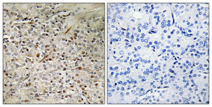 1 - UROC28 Polyclonal Antibody AP73007
