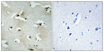 14 - UTP14A Polyclonal Antibody AP73029