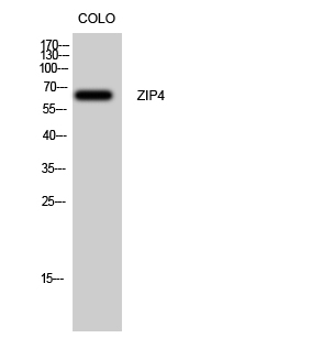 1 - ZIP4 Polyclonal Antibody AP73132