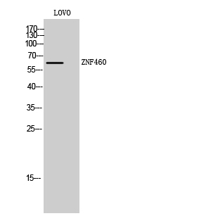 1 - ZNF460 Polyclonal Antibody AP73151