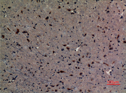 14 - UBE2A/B Polyclonal Antibody AP73264