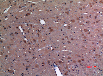 14 - UBE2A/B Polyclonal Antibody AP73264