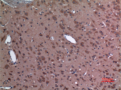 14 - UBE2A/B Polyclonal Antibody AP73264