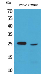 1 - SSX Polyclonal Antibody AP73368
