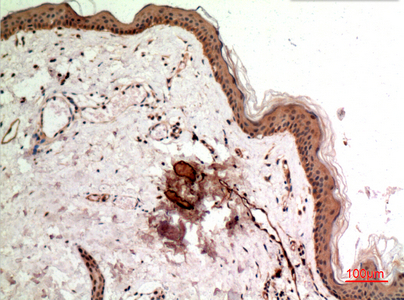 14 - SSX Polyclonal Antibody AP73368