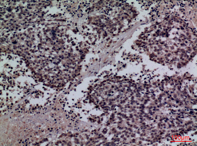 14 - SP-A Polyclonal Antibody AP73374