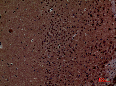 14 - Layilin Polyclonal Antibody AP73405