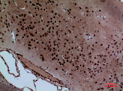 14 - Layilin Polyclonal Antibody AP73405