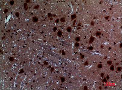 14 - Layilin Polyclonal Antibody AP73405