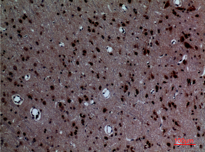 14 - Layilin Polyclonal Antibody AP73405