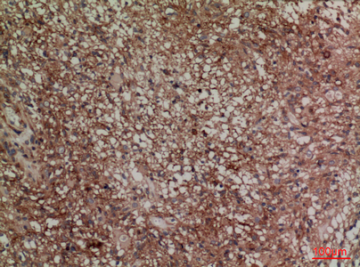 14 - SNAP 23 Polyclonal Antibody AP73414
