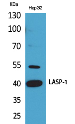 1 - LASP-1 Polyclonal Antibody AP73417