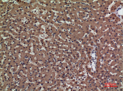 14 - PSG1 Polyclonal Antibody AP73436