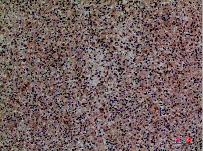 14 - Siglec-5/14 Polyclonal Antibody AP73453