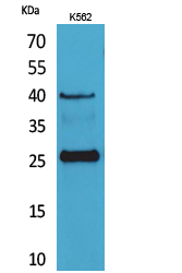 1 - CD161 Polyclonal Antibody AP73459