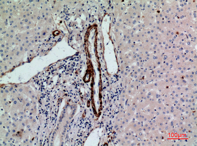 14 - CD241 Polyclonal Antibody AP73467