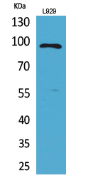 1 - MACC1 Polyclonal Antibody AP73475