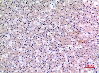 14 - CMTM6 Polyclonal Antibody AP73491