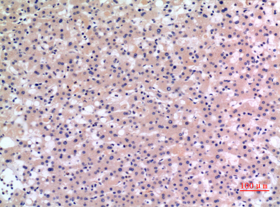 14 - CMTM6 Polyclonal Antibody AP73491