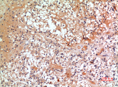 14 - CMTM6 Polyclonal Antibody AP73491