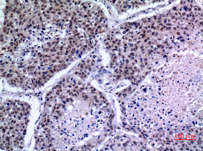14 - KLF13 Polyclonal Antibody AP73513