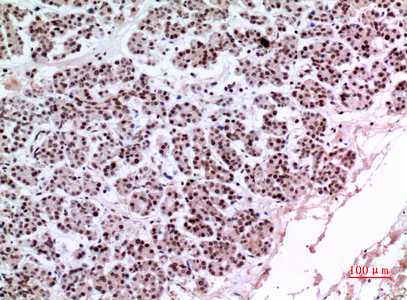 14 - KLF13 Polyclonal Antibody AP73513