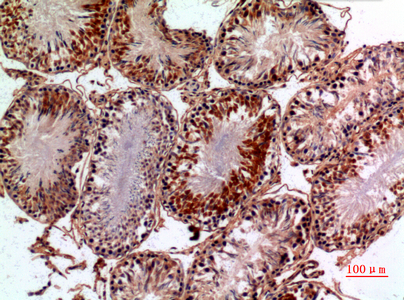 14 - NTE Polyclonal Antibody AP73546