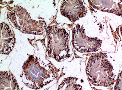 14 - NTE Polyclonal Antibody AP73546