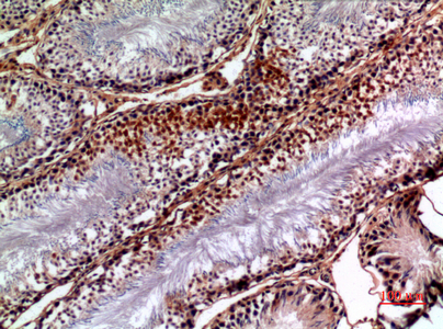 14 - NTE Polyclonal Antibody AP73546