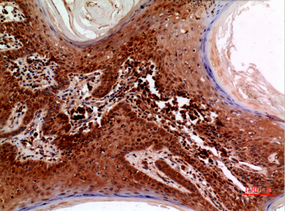 14 - RFC1 Polyclonal Antibody AP73568