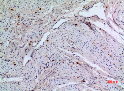 14 - RFC1 Polyclonal Antibody AP73568