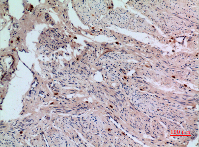 14 - RFC1 Polyclonal Antibody AP73568